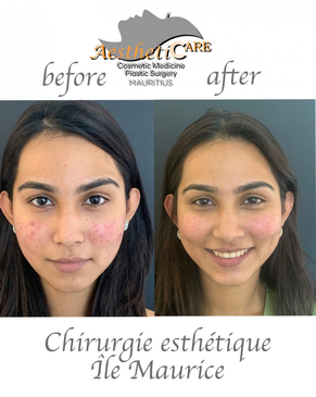 Slider image (2) Aestheticare Ltd